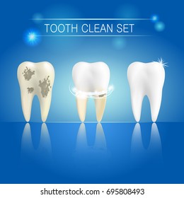 Set of clean and dirty tooth on blue background, clearing tooth process. Teeth whitening concept. Vector illustration