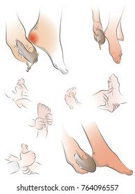 A set of color illustrations on the theme of foot care, foot massage. Color vector illustration of a foot massage.