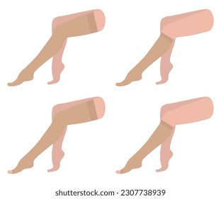 Juego de medias de compresión, de rodilla alta, calcetines, de pie abierto. Nudo, color beige. Piernas hembras sentadas con venas varicosas. Presión sanguínea, hinchazón. Ropa interior médica para los pies. Hosiery para enfermedades.