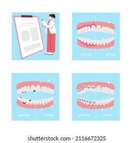Set of concept vector illustrations of orthodontic care procedure. Dental braces and dental plate, baby braces, teeth replacement, cosmetic dentistry abstract metaphor.