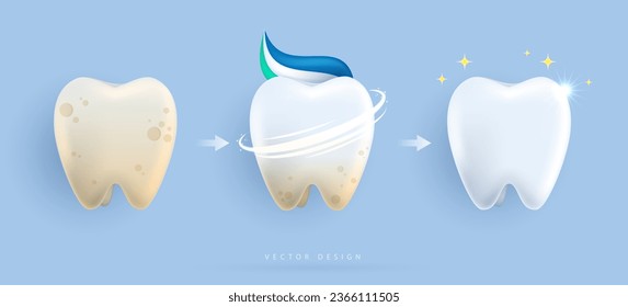 Conjunto de concepto de limpieza dental y blanqueamiento de dientes. comparación de dientes limpios y sucios. cartel de salud dental e higiene bucal para odontología. dientes de examen, blanqueamiento y reparación. diseño vectorial.