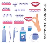Set of design elements about teeth braces flat style, vector illustration isolated on white background. Cleaning equipment, straight and even teeth, stages of orthodontic treatment, smile