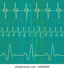 A set of diagrams as a seamless pattern, but each object is fully editable and is located on a separate layer