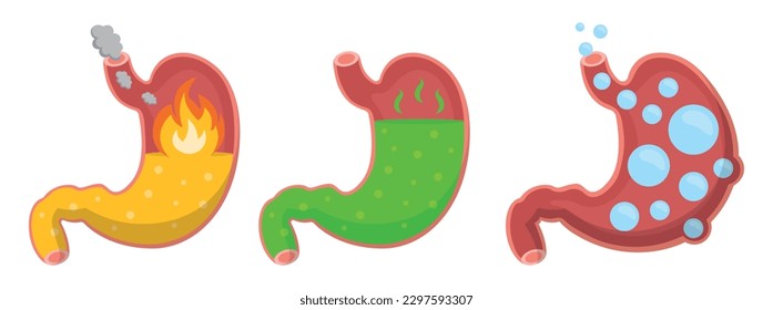 Conjunto de diferentes condiciones del estómago en estilo de dibujos animados. Ilustración vectorial del estómago con diferentes condiciones: hinchazón, ardor de estómago, gas y alta acidez aislados en fondo blanco.