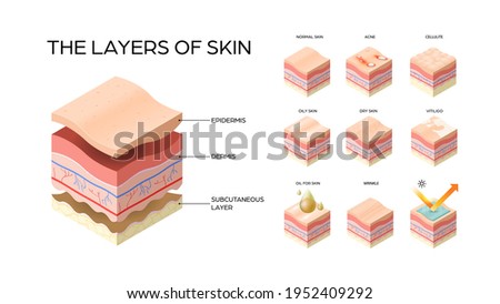 set different types skin layers cross-section of human skin structure skincare medical concept flat horizontal