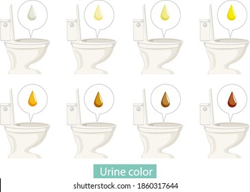 Set Of Different Urine Color Illustration