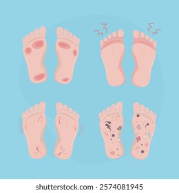 Set of dirty human bare foot, various microorganisms and bacterias on feet. Unsanitary conditions, various pathogens and parasites on unwashed footstep. Health care, microbiology. vector illustration