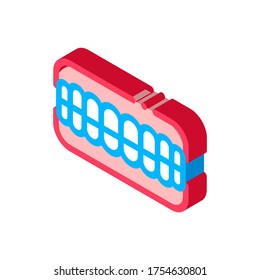 Set Of False Teeth Stomatology vector isometric sign. color isolated symbol illustration
