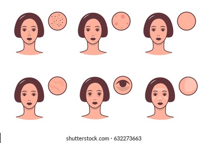 Set of female faces with various skin conditions and problem. Skincare and dermatology concept. Vector colorful illustration.