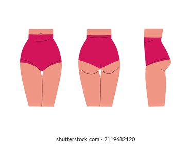 Conjunto de caderas femeninas - vista frontal, trasera, lateral. Hermosa parte del cuerpo en pantalones cortos con ajuste alto. Ilustración de tendencia vectorial aislada en fondo blanco para el diseño.