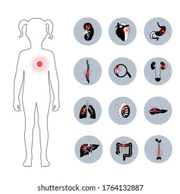 Set with flat vector isolated illustrations of pain and inflammation in child girl body. Digestive system anatomy. Esophagus, stomach, duodenum and other internal organs icon.
