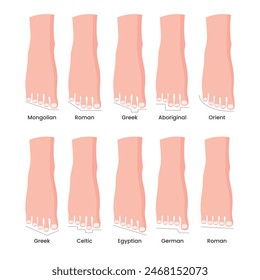 Conjunto de Vector tipo pie concepto detallado con forma mongol, germánica, celta, griega, egipcia, oriental, aborigen y romana, tipos de Formas humanas del antepié, variaciones de la longitud relativa del dedo del pie