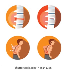 set of  four flat icons with spine's problems