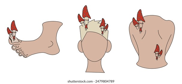 Set of Fungus concept isolated white. Vector illustration of  Micosis Diseases with Toadstoolsl. Flat Fungal Infection art.