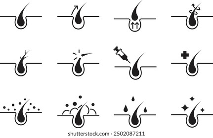 Set von Haarpflege flache Symbole. Haarfollikel Behandlung, Glyphe Silhouette für Trichologie. Glänzende, gesunde Haarzeichen. Gesunde Dermatologie für Epidermis Gefüllte Vektoren einzeln auf transparentem Hintergrund.