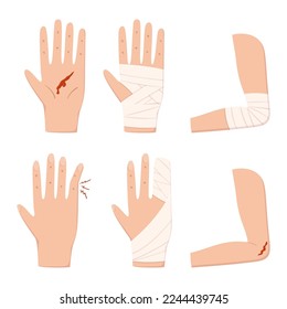 Hand-, Palm-, Elbow-, Finger- und Armverletzung einzeln auf weißem Hintergrund. Erste Hilfe, Gesundheitsfürsorge, Behandlung mit Limb-Trauma, Rehabilitationskonzept. Cartoon-Vektorgrafik