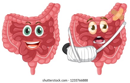 Set of healthy and injured intestine illustration
