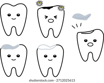 Conjunto de dientes sanos, dientes cariados, dientes tratados y dientes con empastes faltantes