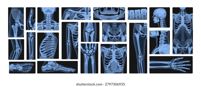 Set of human body x rays. Xrays of skeleton, spine, skull, wrist, arms and legs. Roentgen shots of fractures, bones and joints. Radiography and radiology in hospital. Flat vector illustrations