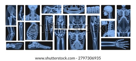 Set of human body x rays. Xrays of skeleton, spine, skull, wrist, arms and legs. Roentgen shots of fractures, bones and joints. Radiography and radiology in hospital. Flat vector illustrations