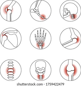 Set of human bone and joint icons. Represents joint diseases: joint inflammation, gout, neuralgia, bursitis, lumbago, sciatica, arthritis, arthrosis.