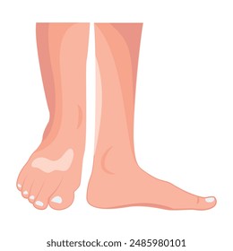 Set of  Human Feet Flat Icons 

