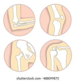 Set Of Human Joints, Elbow, Knee Joint, Hip And Shoulder Joint, Skeletal Bone Structure. Emblem Anatomy And Orthopedic Sign For Medical Diagnostic Center, Vector Illustration.