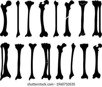 Set of human leg bones isolated on white