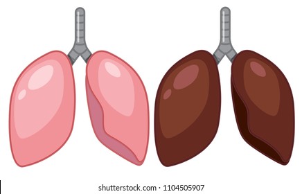 A Set of Human Lung illustration