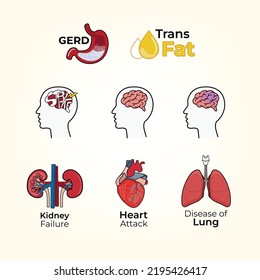 Set human organ symptoms brain, kidney, lung, heart, liver and stomach. vector