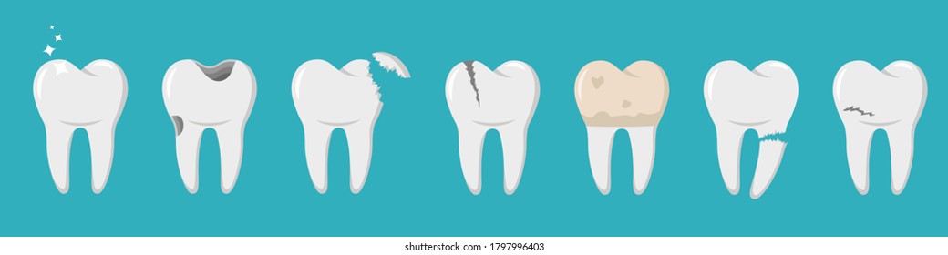 A set of human teeth with different injuries. Healthy and diseased tooth, caries, broken root, plaque, spots, crack. Banner, poster for printing. Infographics in dentistry. Vector. Flat style