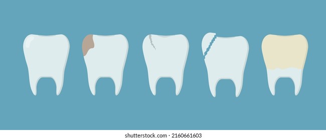 Set of human teeth with different injuries. Healthy tooth, tooth with caries, plaque, crack and broken. Template for stomatology or dentistry. Dental care Concept.