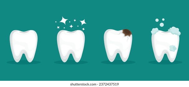 A set of human teeth.. Healthy and diseased tooth, caries, and shining Banner, poster for printing. Infographics in dentistry. Vector. 