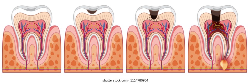 A Set of Human Tooth illustration