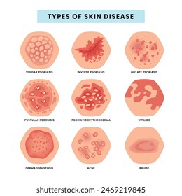 Conjunto de Iconos para Diferentes Enfermedades de la Piel de la Cara, Problemas de la Piel, Tipos de Acné, Espinillas de la Piel y Comedones de la Cara, Tipos de psoriasis, Parte de la piel con dermatitis, Anuncio de infografía médica.