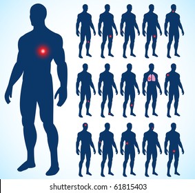 Set of illness people with pain dots. Vector illustration.