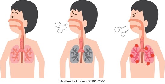 Establecer la ilustración de la condición pulmonar