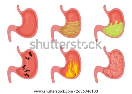 Set of illustrations depicting various conditions of the human stomach, ranging from a healthy state to different problems, providing a visual guide to digestive health issues