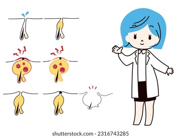 Set of illustrations of pore conditions and dermatologist