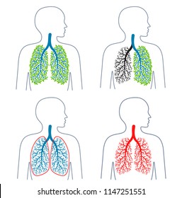 Set of illustrations of respiratory system theme.Tuberculosis. Lung disease. Lungs' cancer.  Promotion of healthy lifestyles. Medicine, health and ecology. Vector illustration.