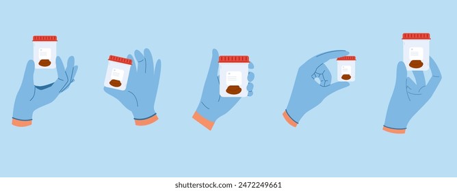 Set von Illustrationen mit Stuhlanalyse. Ärztliche Hände in blauen Handschuhen halten Behälter mit Kotproben