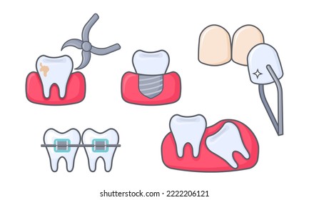 Set of illustrations with teeth in flat style isolated on white background. Dental concept for your design. Illustration for dentistry, braces, dental implant, tooth extraction. Oral hygiene