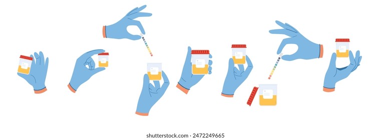 Set of illustrations with urine analysis. Doctor hands in blue gloves hold containers with pee sample