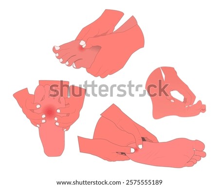 A set of illustrations of various foot health problems, designed with medical details yet aesthetic and easy to understand. for educational materials, medical presentations, or health content design.