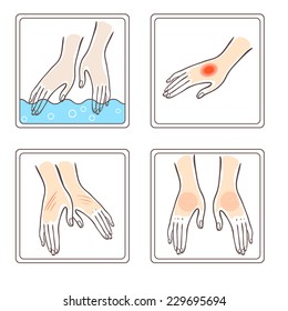 Un conjunto de Imágenes en condición de mano