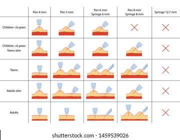 Set Of Insulin Injection Technique In Diabetes For Adults And Children, Depending On Length Of The Needle And Fat Thickness. Anatomical Vector Illustration In Flat Style Isolated On White Background.