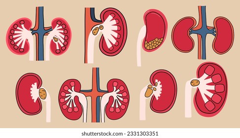 Un conjunto de riñones con piedras dentro. Ilustración vectorial en estilo plano