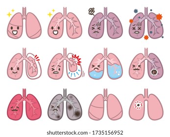 Set of lung disease illustrations