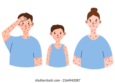 Set monkeypox virus symptom on patient with fever, headache, swollen lymph node, rashes on face, body and back, muscle aches.