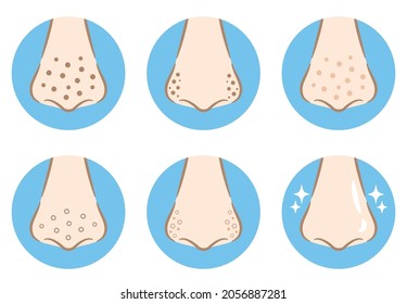 Set Of Nose Pore Dirt Illustration Icons